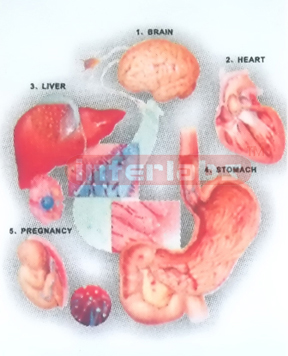 HANGING HUMAN ALCOHOL DISEASES MODEL DEMONSTRATING